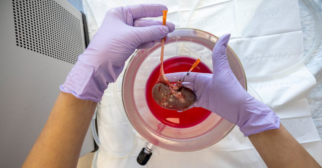 This Kidney Was Frozen for 10 Days. Could Surgeons Transplant It? This Kidney Was Frozen for 10 Days. Could Surgeons Transplant It?